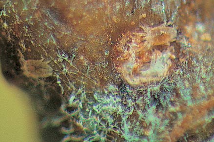 The mites can be seen with a small microscope