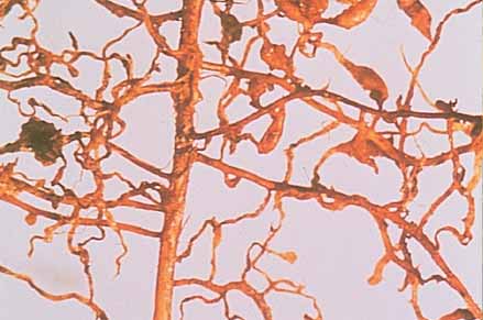 Fleshy yellow phylloxera galls on fibrous roots contain aphids and eggs